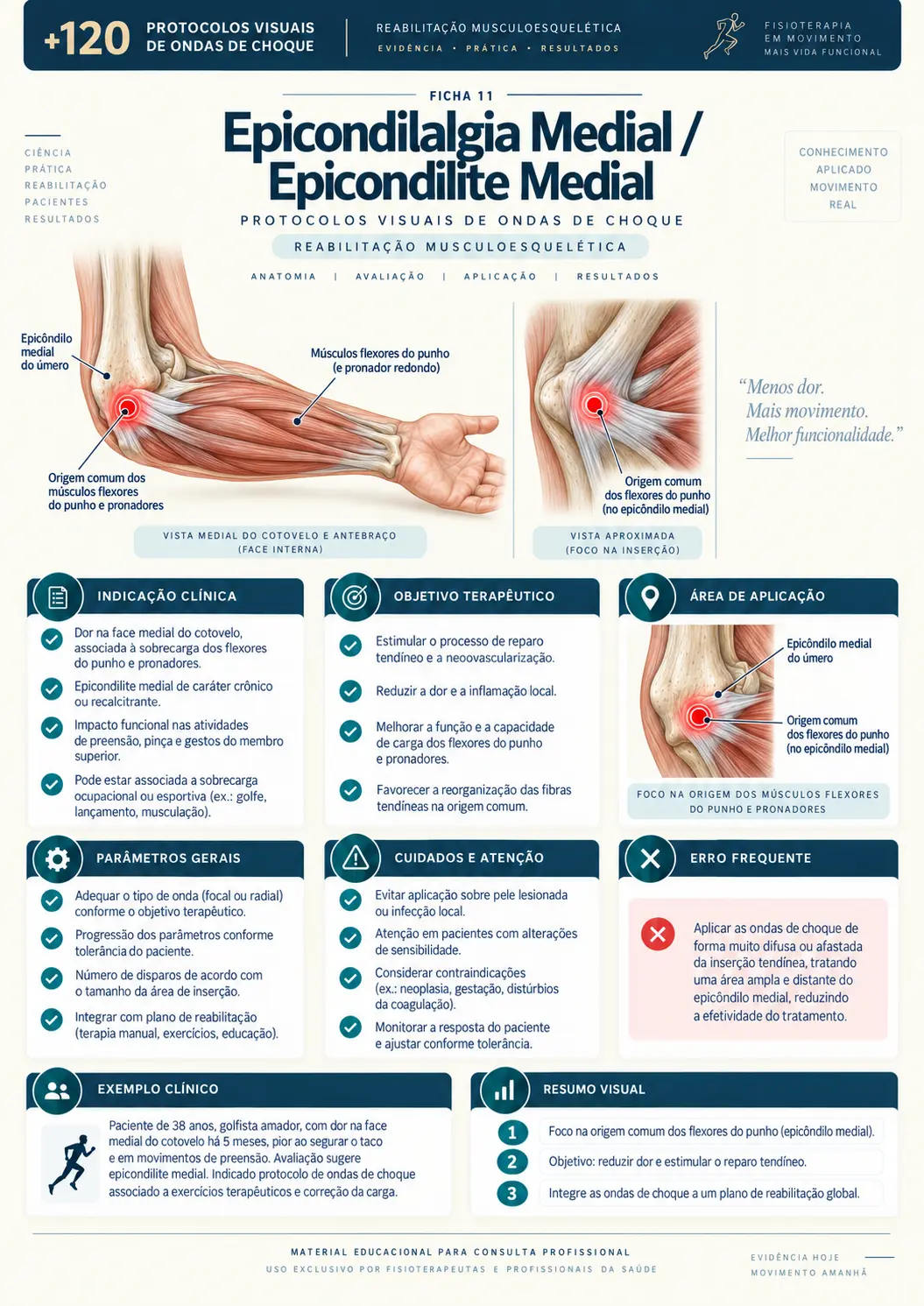 Epicondilite Medial