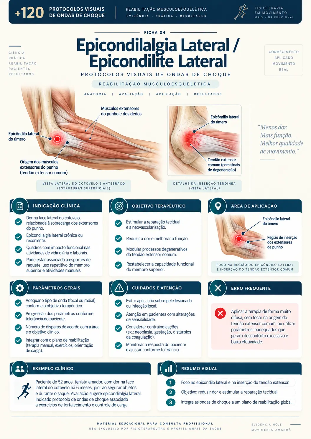Epicondilalgia Lateral / Epicondilite Lateral